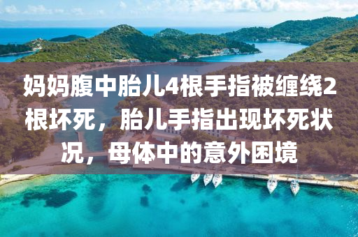 妈妈腹中胎儿4根手指被缠绕2根坏死，胎儿手指出现坏死状况，母体中的意外困境